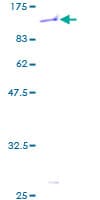 Human ZNF45 Protein (Recombinant GST)
