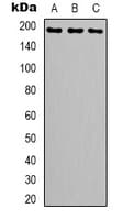 TOP2A / Topoisomerase II Alpha Antibody (C-Terminus)