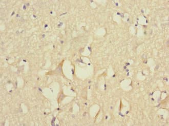 Polyclonal Rabbit anti-Human FGF12 Antibody (IHC)