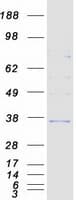 Human HSD17B6 Protein (Recombinant Myc-DDK (Flag))