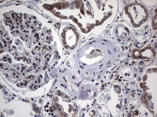 MTDH / Metadherin Antibody (aa70-582, clone OTI1B6)