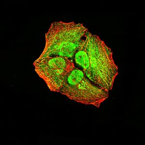 Monoclonal Mouse anti-Human ALK2 / ACVR1 Antibody (clone 2E2C11, IHC, WB)