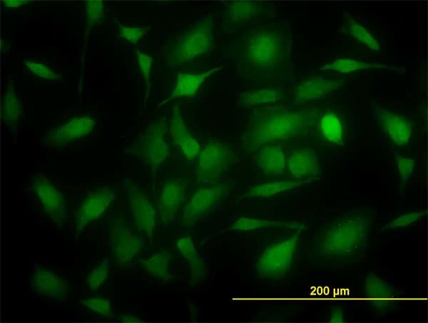 TS / Thymidylate Synthase Antibody (clone 3A1)