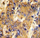 MSRB2 / MSRB Antibody (aa44-73)