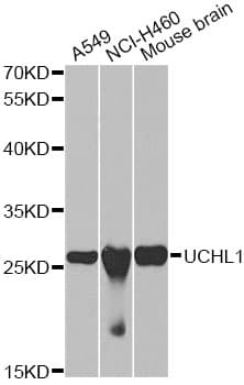 UCHL1 / PGP9.5 Antibody