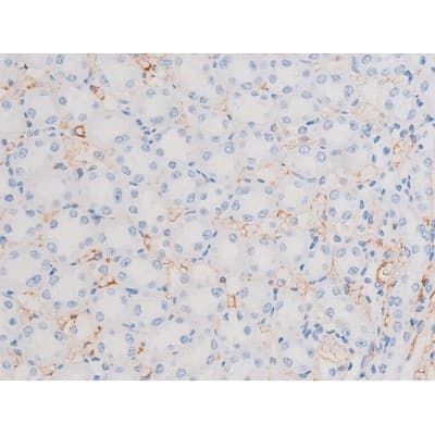 IRS1 Antibody (phospho-Ser639)