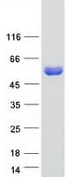 Human DYNC1LI2 Protein (Recombinant Myc-DDK (Flag))