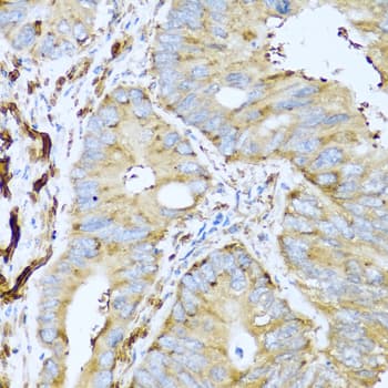 Polyclonal Rabbit anti-Human Placental Lactogen Antibody (IHC, WB)