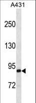 EPS8L2 Antibody (aa162-190)