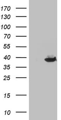THTPA Antibody (aa2-230, clone OTI5F7)