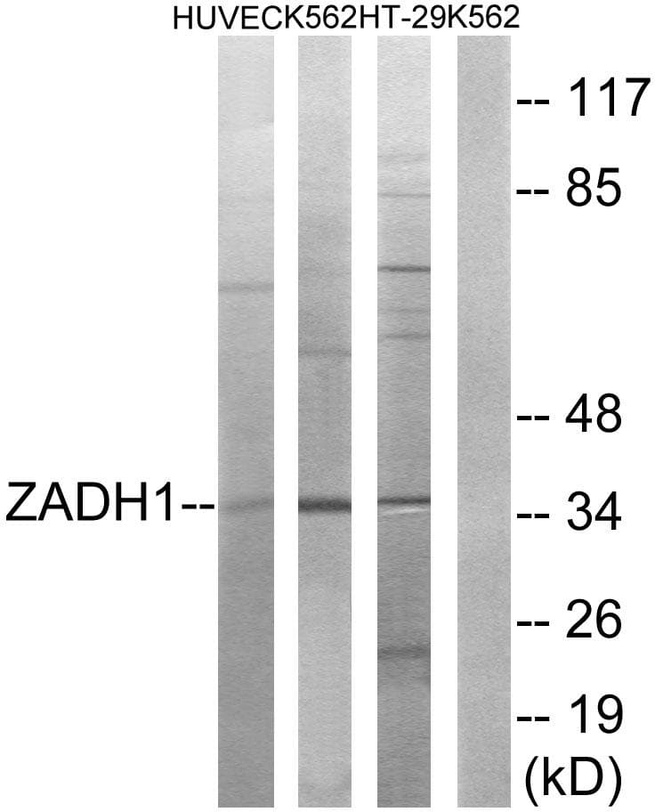 PTGR2 / PGR2 Antibody
