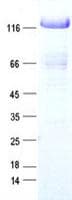 Human TRIM33 / TIF1-Gamma Protein (Recombinant DDK,C-terminus)
