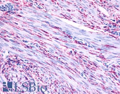 PathPlus™ Polyclonal Rabbit anti-Human ADRA1B / Adrenoceptor alpha 1B Antibody (Cytoplasmic Domain, IHC)