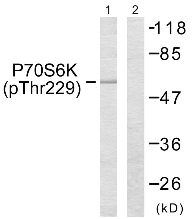 Polyclonal Rabbit anti-Human RPS6KB1 / P70S6K / S6K Antibody (phospho-Thr229, IHC, WB)