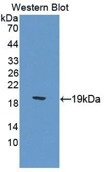CALCR / Calcitonin Receptor Antibody (aa42-170, FITC)