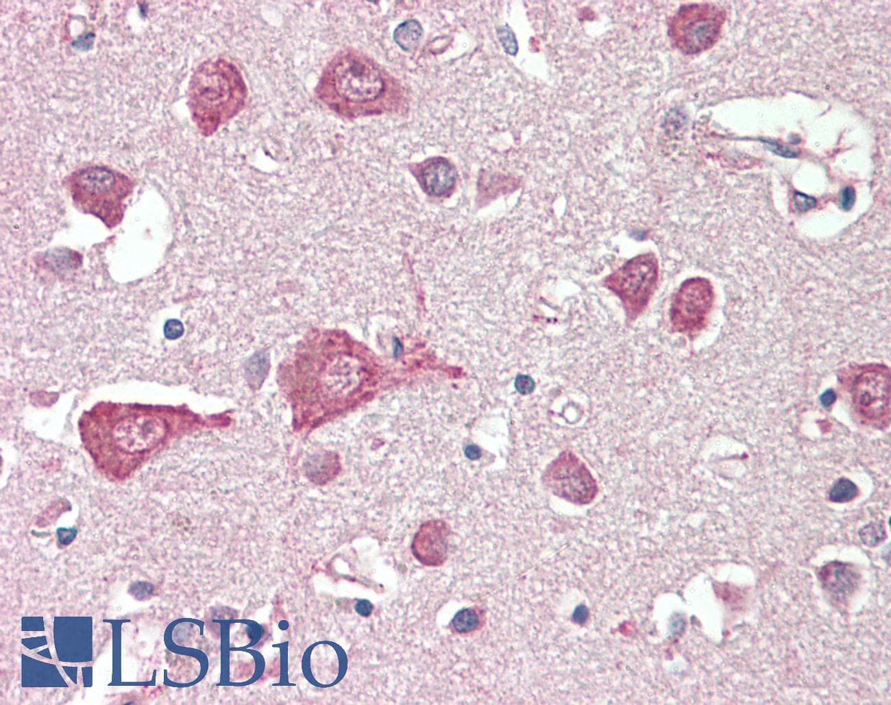 IHC-plus™ MLC1 / MLC Antibody (aa179-193)