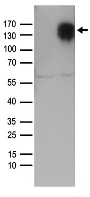Polyclonal Rabbit anti-Human SELP / P-Selectin / CD62P Antibody (WB)