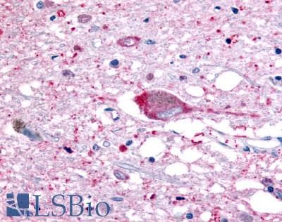 PathPlus™ Polyclonal Rabbit anti-Human GPR32 Antibody (Extracellular Domain, IHC)