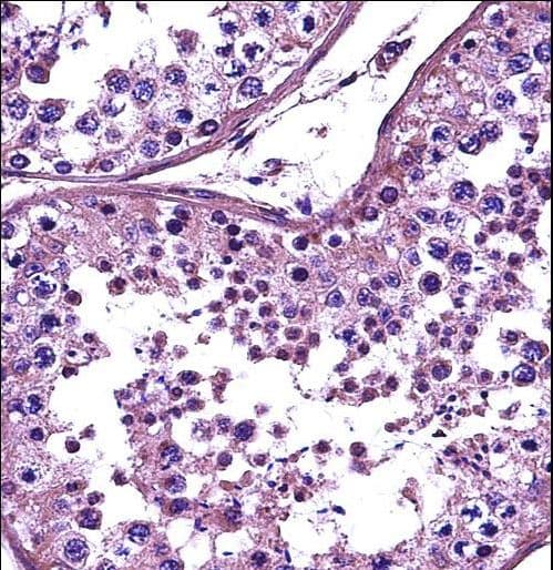 HDAC4 Antibody (aa1049-1077)
