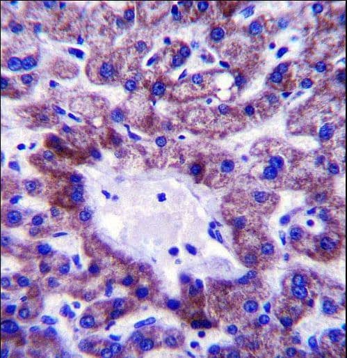 Polyclonal Rabbit anti-Human NADK2 / C5orf33 Antibody (aa122-150, IHC, WB)