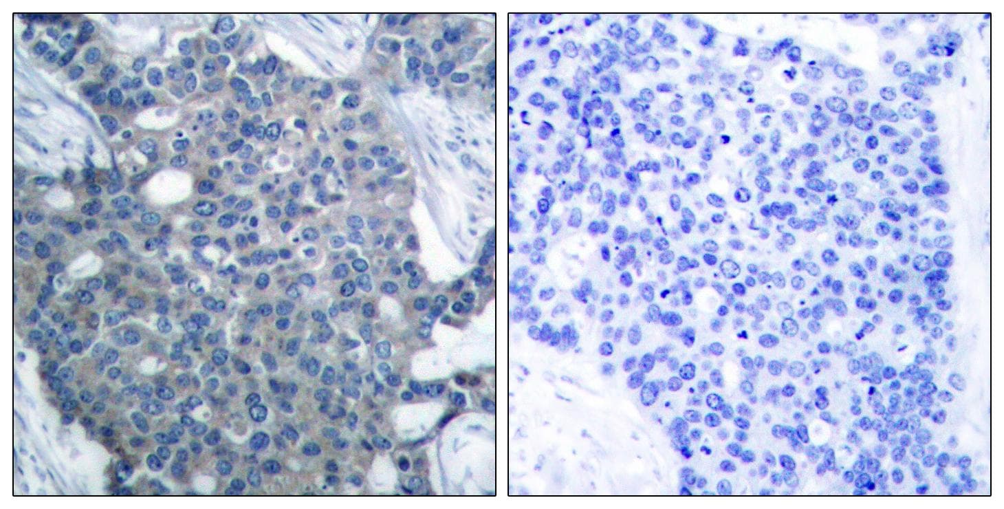 Polyclonal Rabbit anti-Human STMN1 / Stathmin / LAG Antibody (p24, IHC, WB)