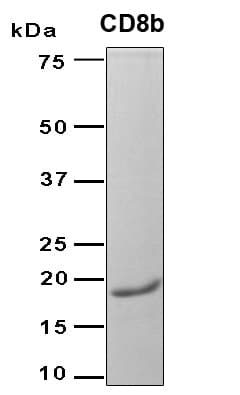 Human CD8B / CD8 Beta Protein (Recombinant 6His, N-terminus)