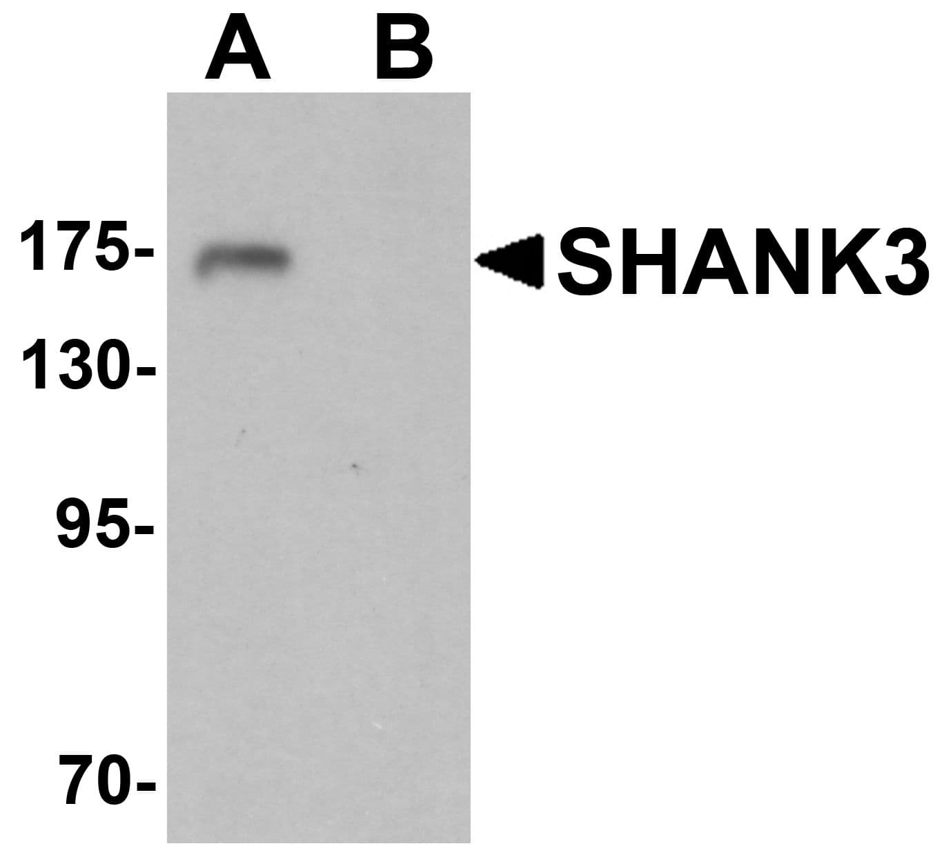 SHANK3 Antibody