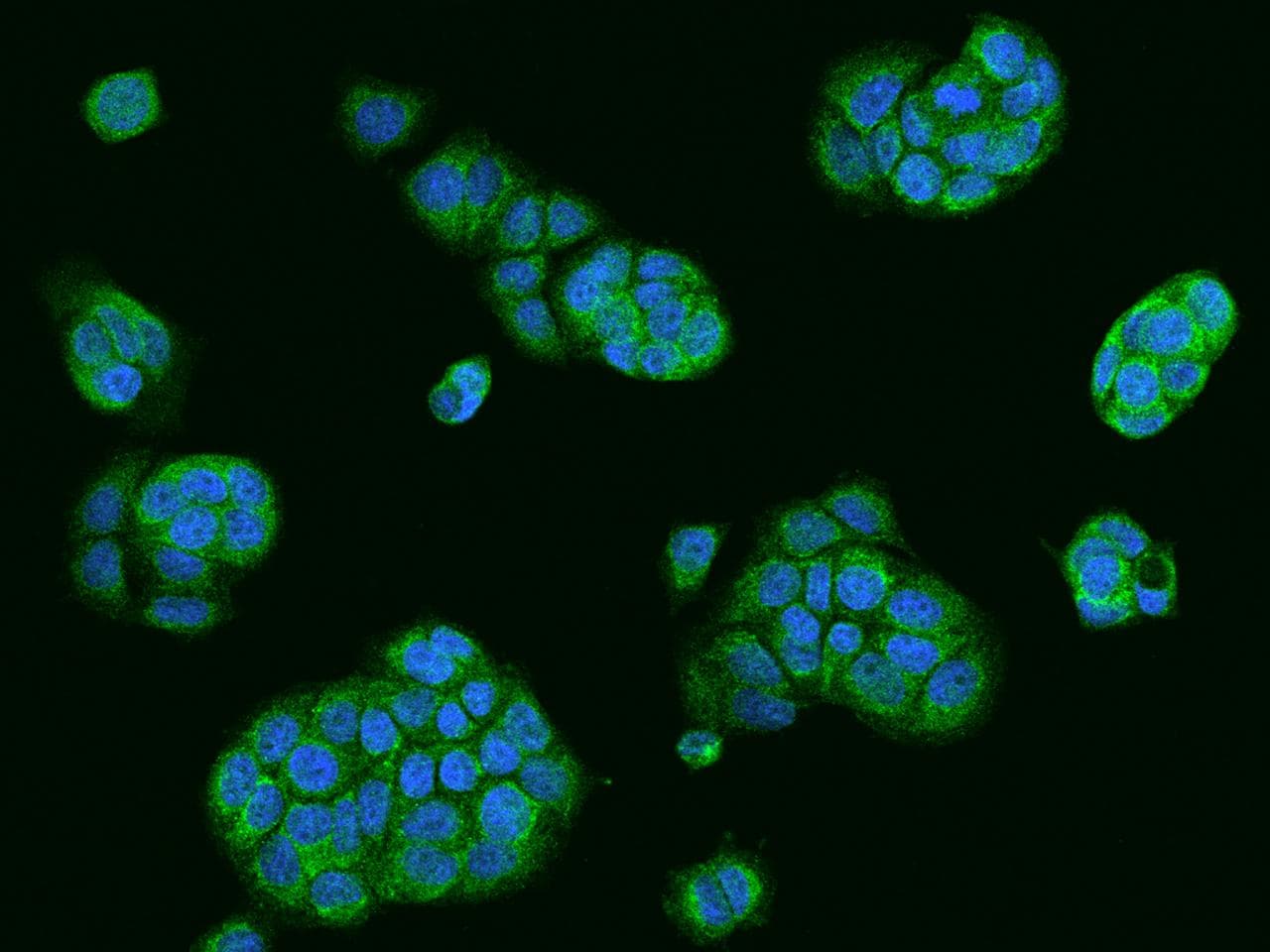 Polyclonal Rabbit anti-Human USE1 / p31 Antibody (IHC, IF, WB)