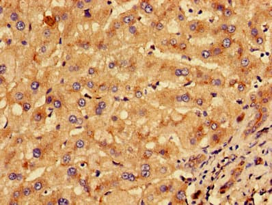 KLHL2 / MAV Antibody