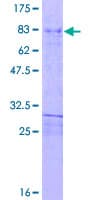 Human HOXD3 Protein (Recombinant GST)