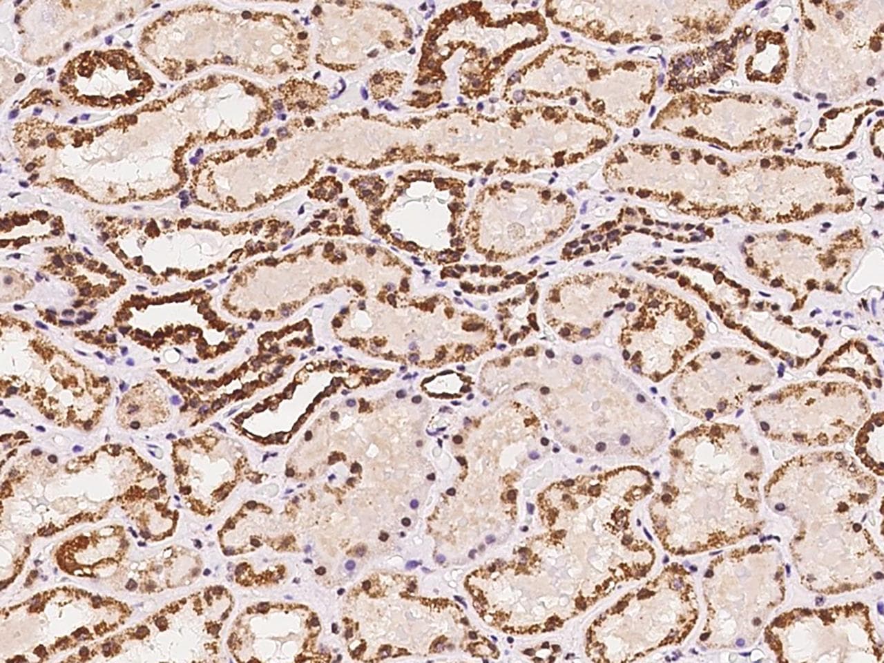 EXOSC2 / RRP4 Antibody