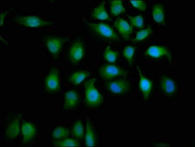 Polyclonal Rabbit anti-Human ABHD6 Antibody (IHC)