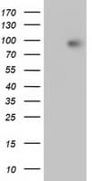 CTNNB1 / Beta Catenin Antibody (clone OTI3F9)