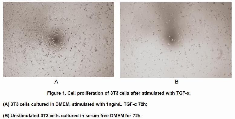 Human AMH / Anti-Mullerian Hormone Protein (Recombinant His, N-Terminal)