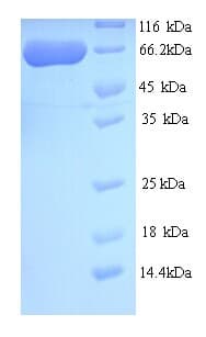 Human C10orf2 / PEO1 Protein (Recombinant His)
