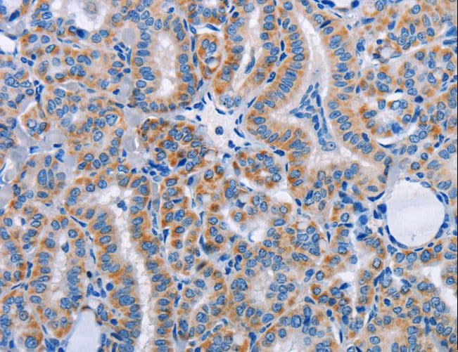 Polyclonal Rabbit anti-Human FN1 / Fibronectin Antibody (IHC)