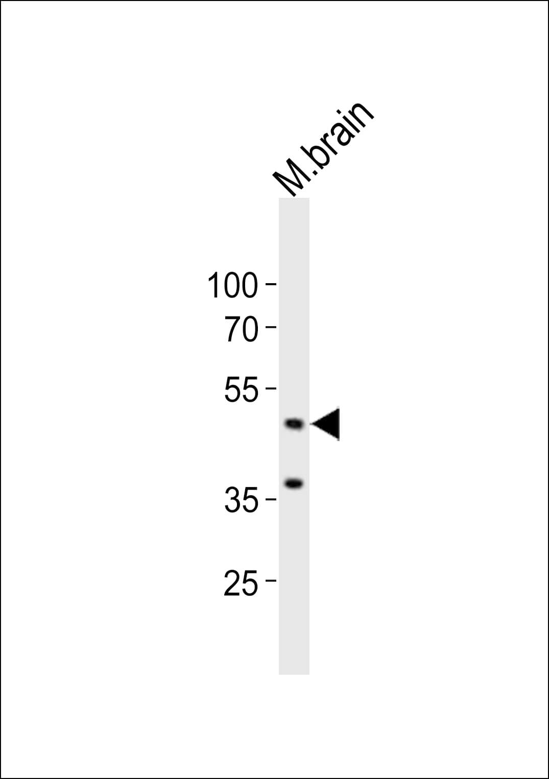 EED Antibody (aa40-74)