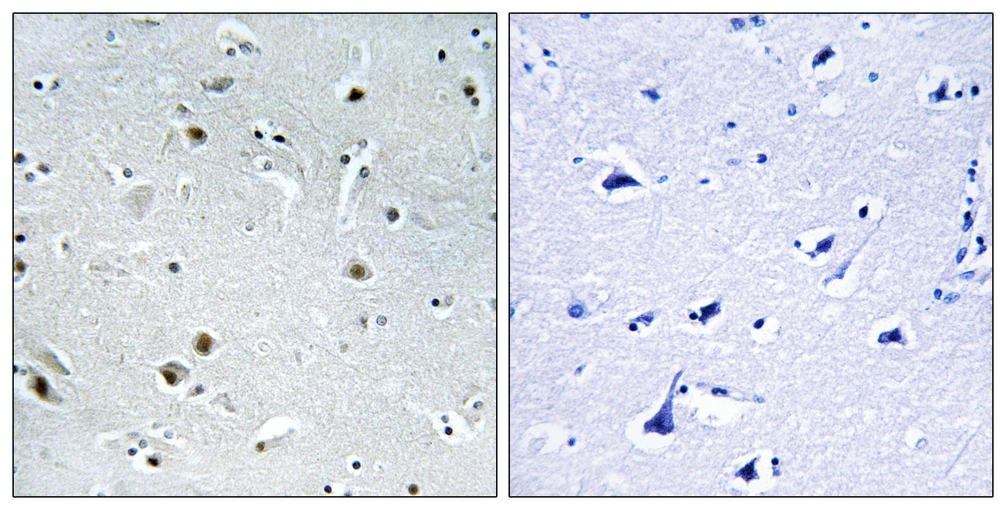 Polyclonal Rabbit anti-Human DDX24 Antibody (IHC)