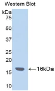 ITIH4 Antibody (aa29-157)
