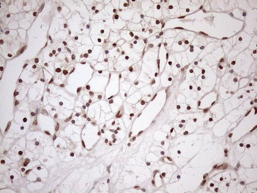 MGMT Antibody (clone OTI4F9)