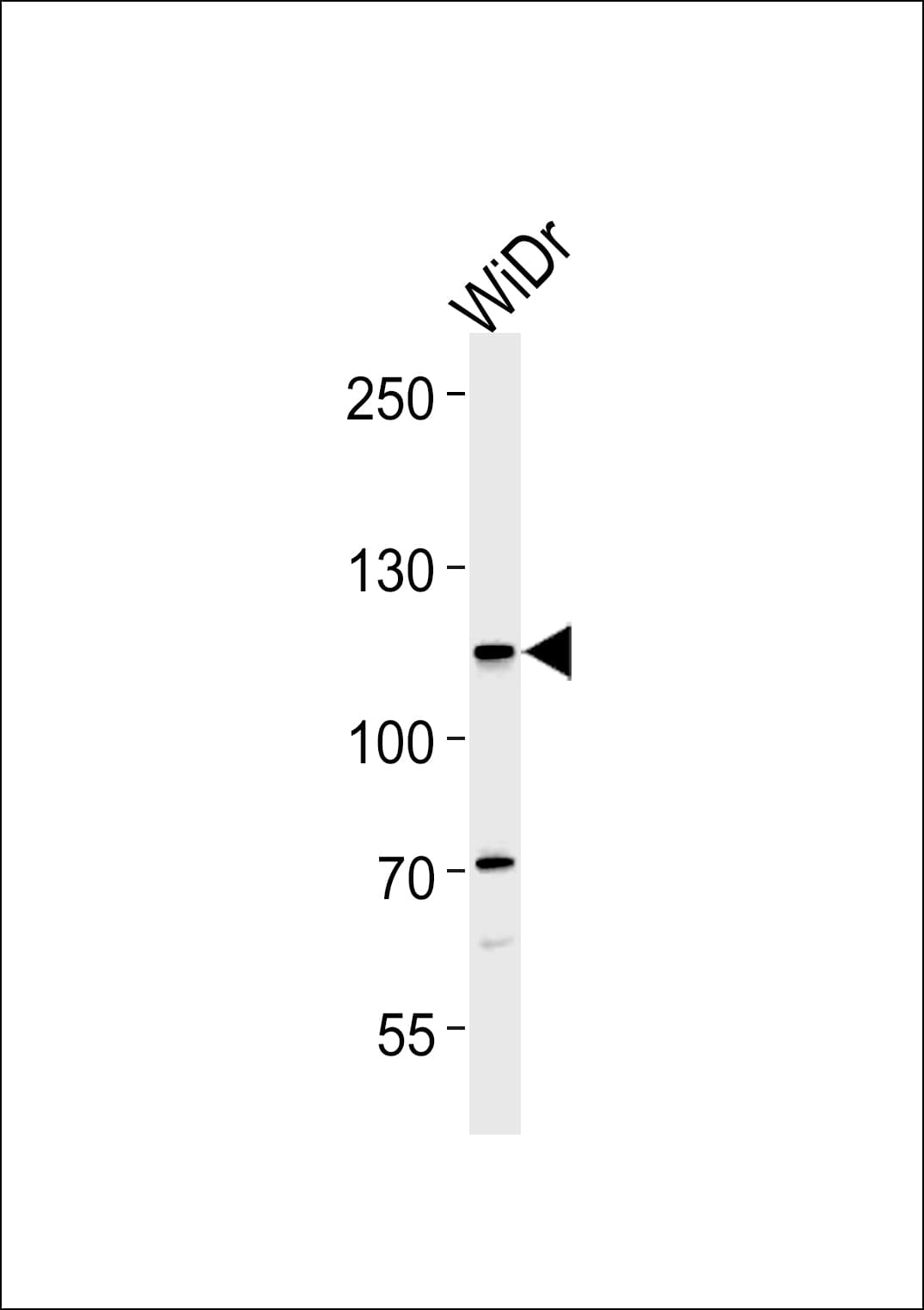 CARD6 Antibody