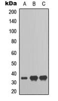RAD51L3 / RAD51D Antibody (Internal)