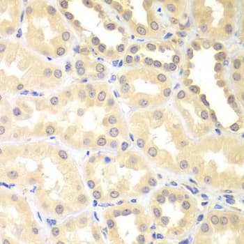 Polyclonal Rabbit anti-Human DTX2 Antibody (IHC, WB)