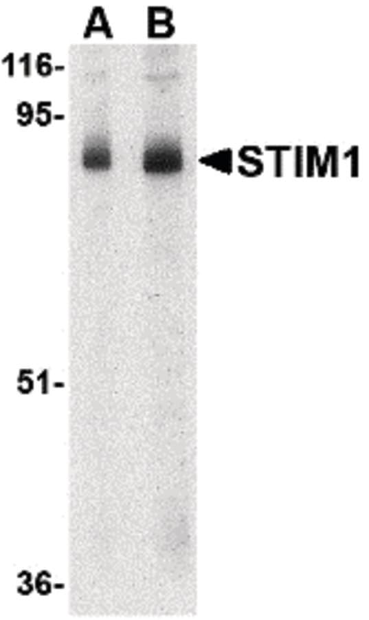 IHC-plus™ GOK / STIM1 Antibody