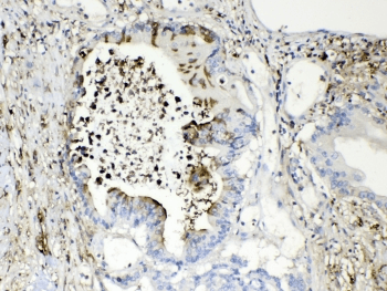 Polyclonal Rabbit anti-Human TMEM107 Antibody (IHC, WB)