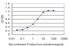 PR / Progesterone Receptor Antibody (clone 3E11)