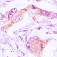 MRPL13 Antibody (C-Terminus)