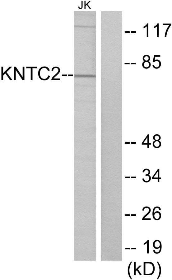 HEC1 / NDC80 Antibody