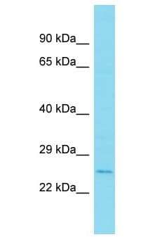 Polyclonal Rabbit anti-Human MYL10 Antibody (aa31-80, WB)