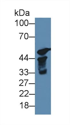 CYP17 / CYP17A1 Antibody